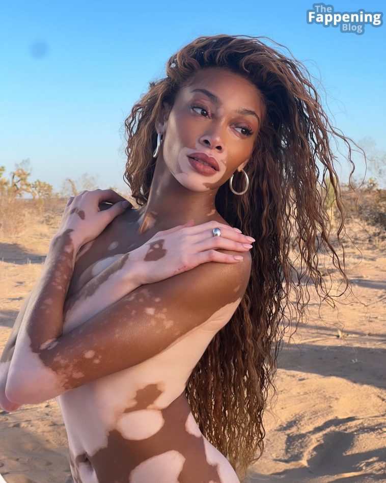 Winnie Harlow Poses Naked for Women’s Health Magazine (16 Photos)